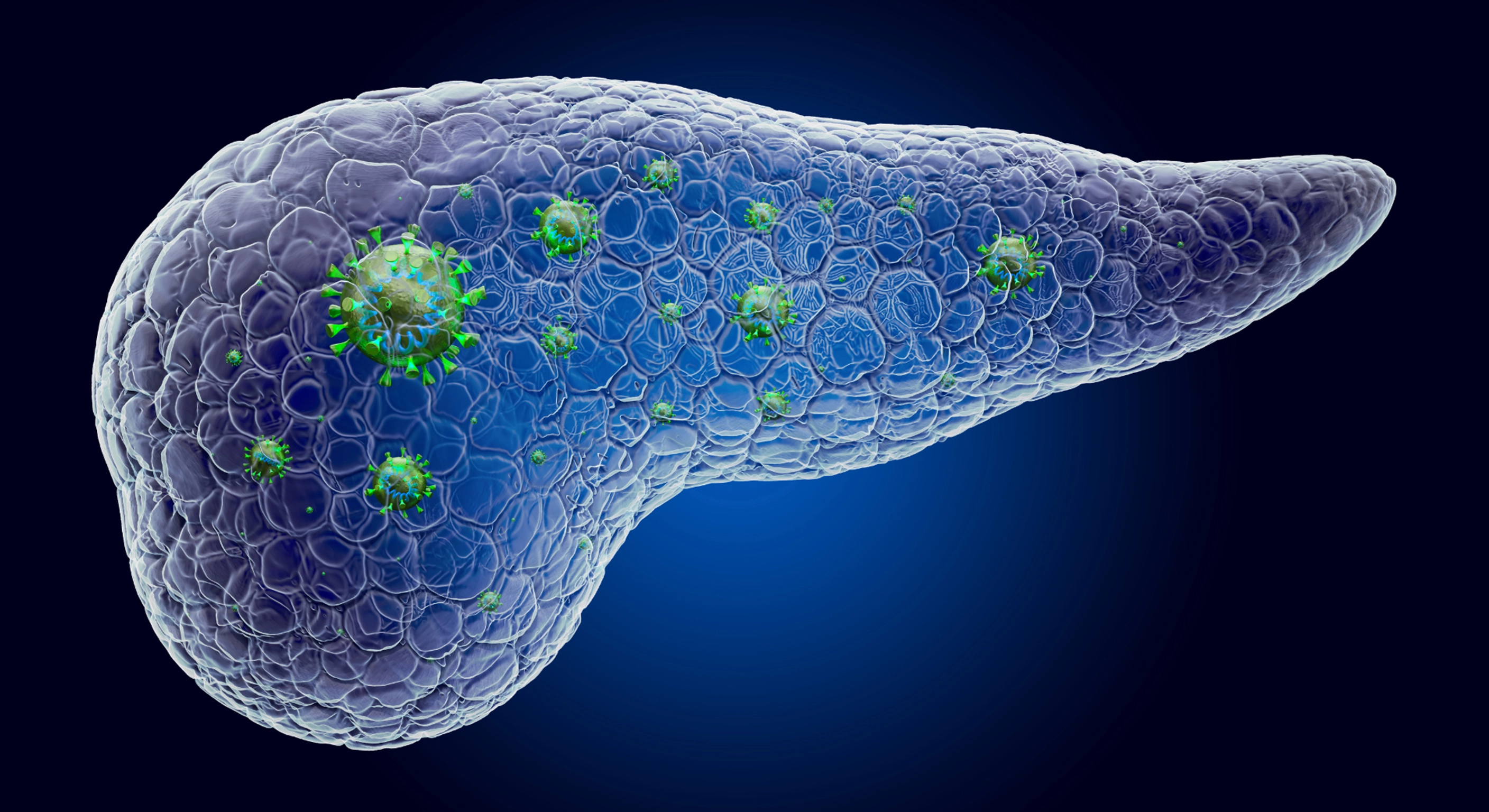 Alcohol-Related Liver Disease