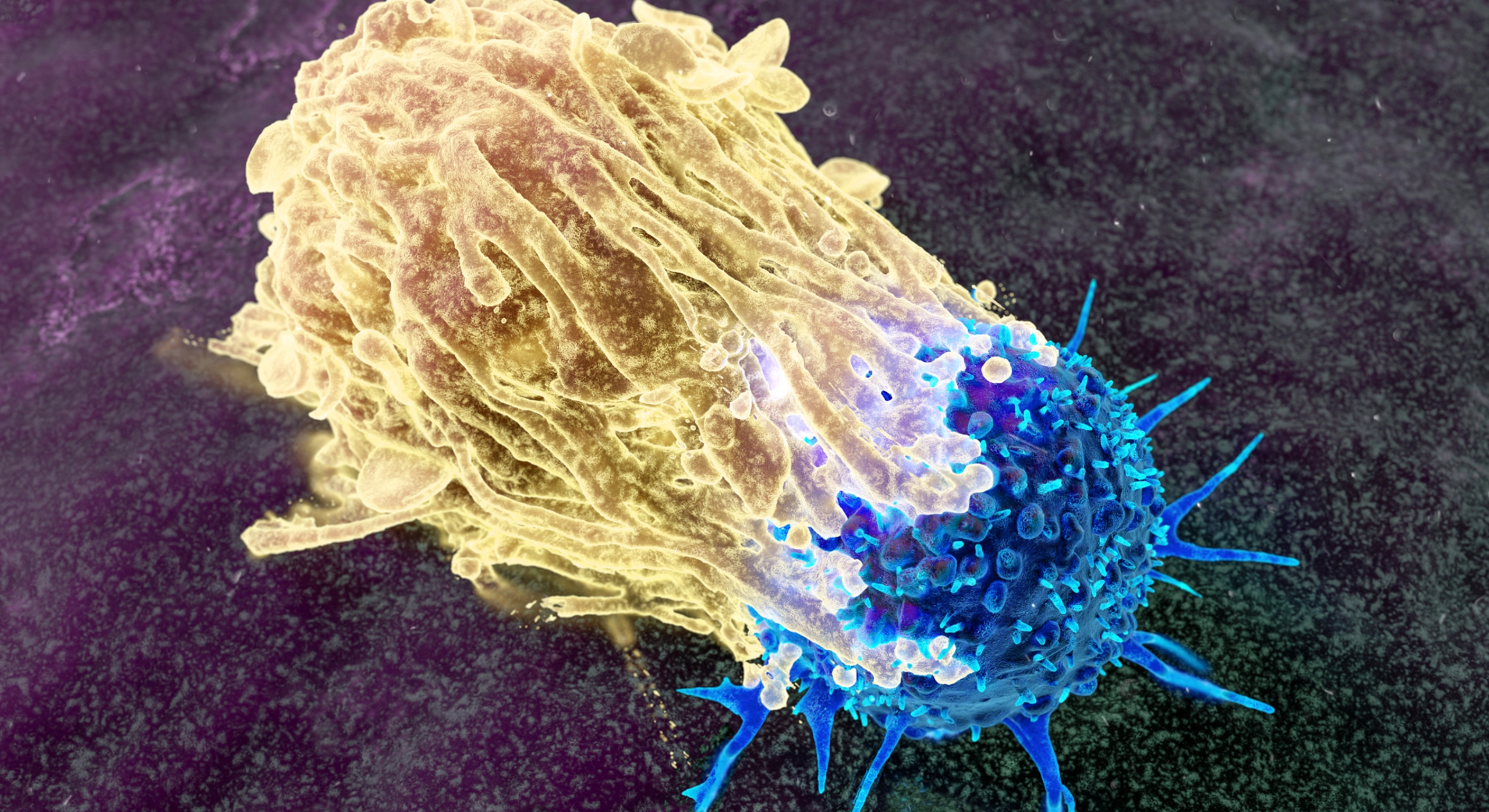 Autoimmune Liver Disorders